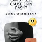 Can Stress Cause Skin Rash? - Get Rid of STRESS RASH