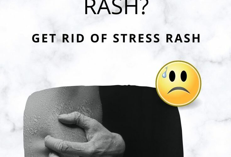 Can Stress Cause Skin Rash? – Get Rid of STRESS RASH