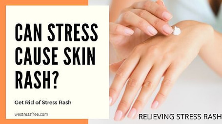 Can Stress Cause Skin Rash? – Get Rid of STRESS RASH | We Stress Free