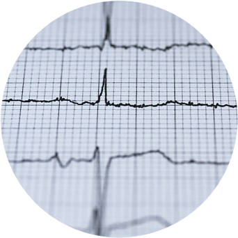 Stress ECG Test